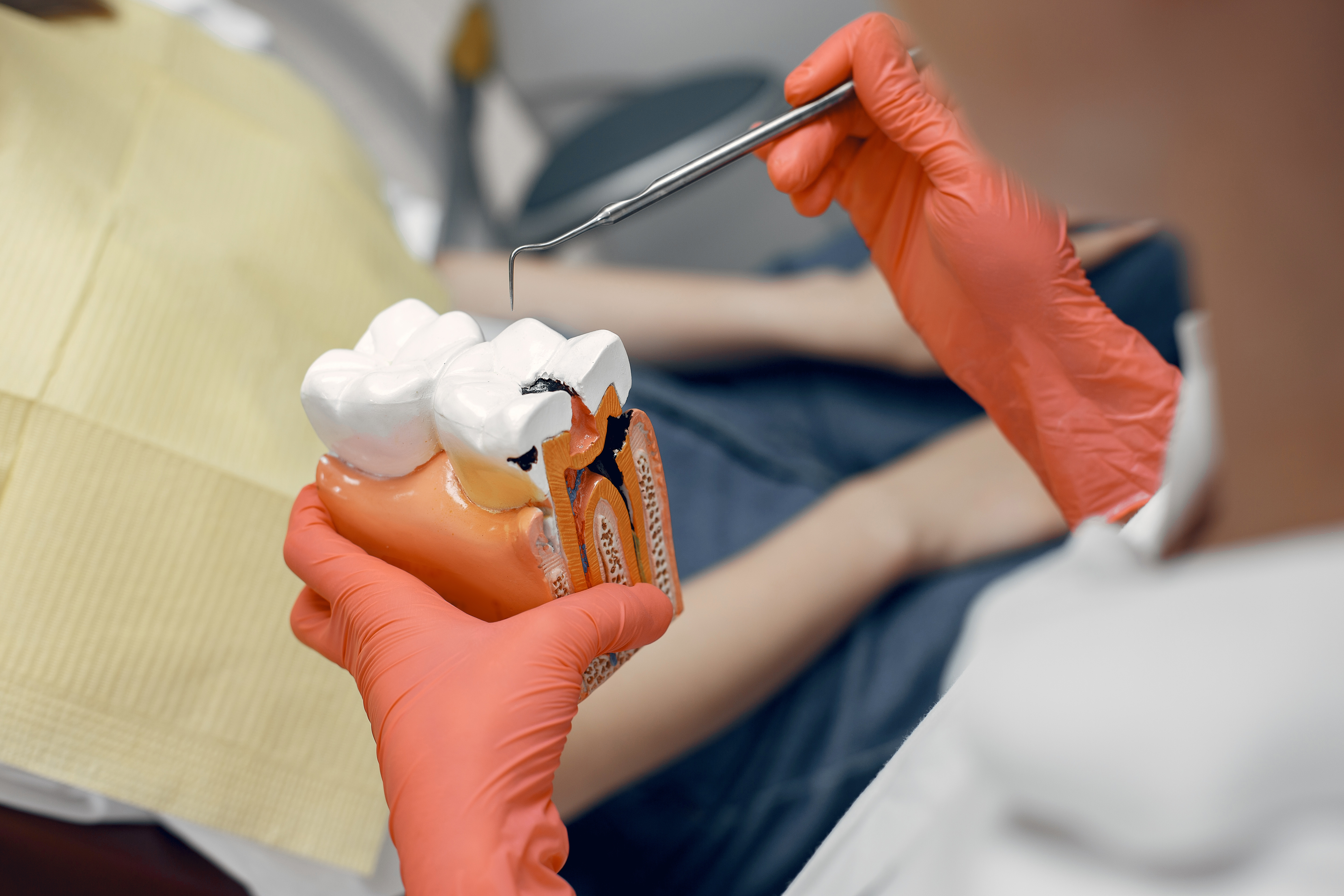 Tooth Extraction  in Pune